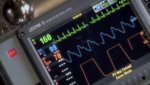 LIFEPAK 15 Monitor Defibrillator - Screen