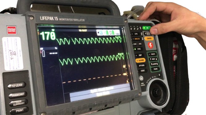 LIFEPAK 15 Monitor Defibrillator (17)